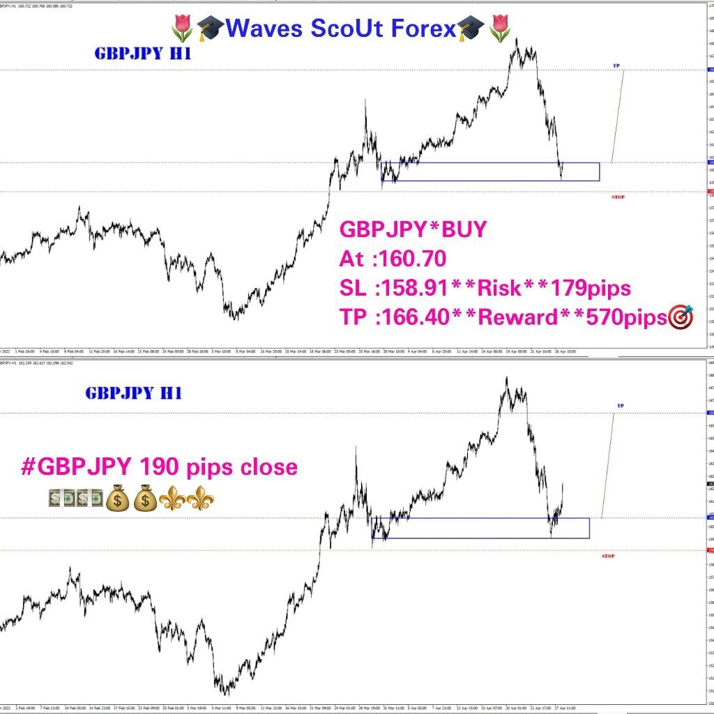 BEFORE+AFTER * GBP/JPY 